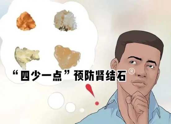 肾结石避免不了生姜蒜子（肾结石生姜能不能吃?）-图3