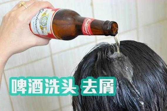 生姜米醋啤酒治白头发（生姜醋啤酒洗头发可以变黑吗）