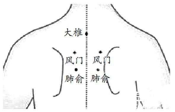 咳嗽用生姜擦背（咳嗽擦姜擦那部位）-图2