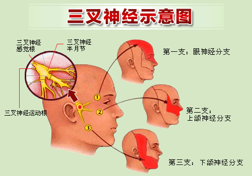 生姜治三叉神经-图2