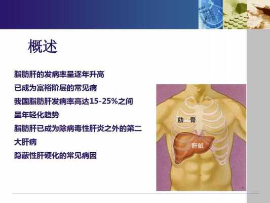 生姜降脂肪肝的原理-图1