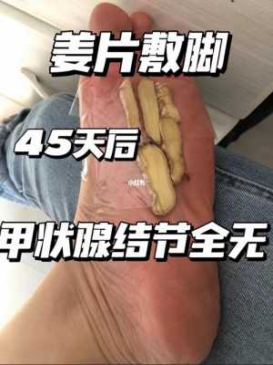 生姜与甲状腺