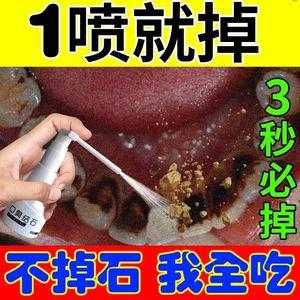 白醋和生姜怎么去除牙结石-图2