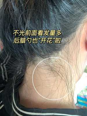 用生姜洗头会掉头发吗女-图3