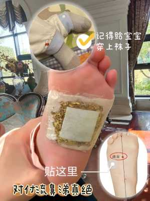 婴儿发烧脚底贴生姜可以吗